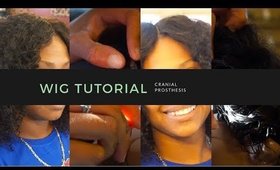 Making a Cranial Prosthesis for my Mom (Closure Wig) No Leave out!