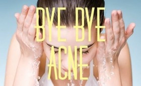 Overnight Acne Treatment