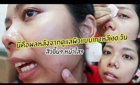 หลังจากดูแลผิวแบบสาวเกาหลีครบ 30 วัน (10 step korean skin care routine)#2 | Licktga