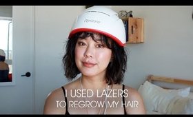 hair regrowth for hair loss and thinning hair | iRestore Professional