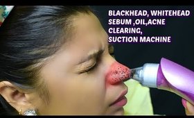 VACUUM BLACKHEAD REMOVAL  | SuperPrincessjo