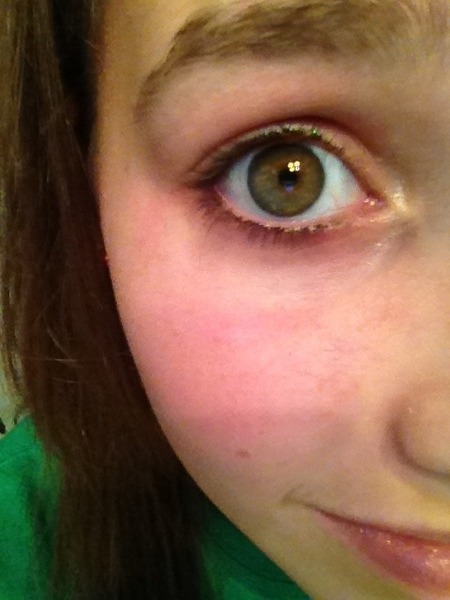 seeing colored spots before your eyes seeing colored spots before your eyes