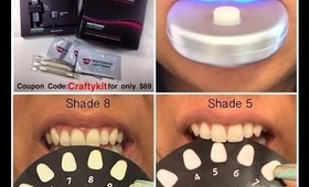 Whitening Lightning How to Whiten Your Teeth in 20 Minutes