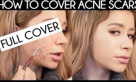 HOW TO COVER ACNE SCARS
