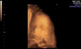28 week ultrasound 3d/4d