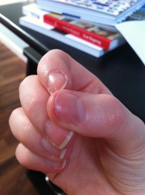 Any tips or tricks to get my thumb back into a healthy state?:( 
I promise to stop picking it. It just hurts:( 