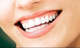 ♡ Whiten Your Teeth Instantly (How I Do It) ♡
