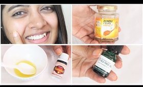 Top 5 uses of Vitamin E Capsules for Skin & Hair || ACNE SPOTS, LIGHTENING... | SuperWowStyle Prachi
