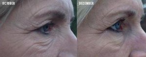 aging results, w/ the new amp md
