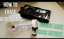 BANISH ACNE SCARS Review + How To Erase Acne Scars FAST