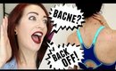 BACNE?! HOW TO REMOVE BODY & BACK ACNE! Bacne Home Remedies & Treatments!