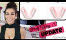 Aligners for Straight Teeth At Home! | Half Way Update | Smile Direct Club