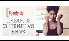 Concealing Discolored Knees + Elbows