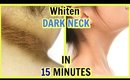 How To Whiten Dark Neck And Dark patches In 15 Minutes |SuperPrincessjo