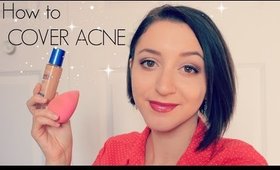 How to Cover ACNE | BLEMISHES | SCARS