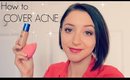 How to Cover ACNE | BLEMISHES | SCARS