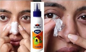 Can Fevicol Remove Blackheads? _ Viral DIY Tested! || remove blackheads with fevicol for blackheads