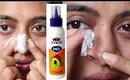 Can Fevicol Remove Blackheads? _ Viral DIY Tested! || remove blackheads with fevicol for blackheads