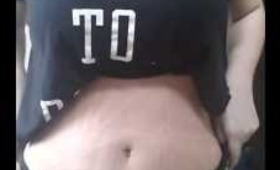 Tummy tuck post op day 11