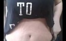 Tummy tuck post op day 11