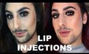 My Lip Injection Experience | Brandon Nitti