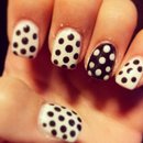 Pois's nails