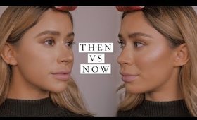 HOW MY FACE HAS CHANGED | Then VS Now