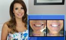 ** Teeth Whitening **My New Obsession