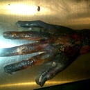 MORGUE BURNT CRISPY HAND
