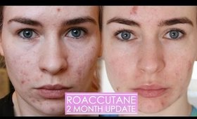 2 MONTH ROACCUTANE UPDATE - Side effects & my skin now