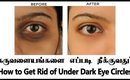 கருவளையம் எப்படி ஈஸியா குறைப்பது | Reduce Under Eye Dark Circles