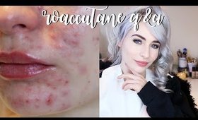 ROACCUTANE Q&A - Mental Health, Side Effects & Products!