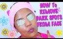 How to Remove Dark Spots From Your Face Naturally | SuperPrincessjo