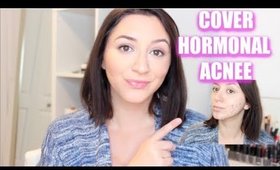 HOW TO COVER HORMONAL PREGNANCY ACNE | PREGNANCY FOUNDATION ROUTINE
