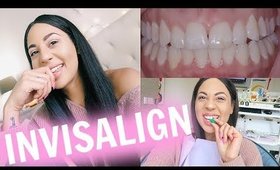 My Invisalign Experience!