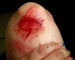 Practica heridas basicas
Alter Maquillaje Profesional
www.facebook.com/AlterMaquillaje
