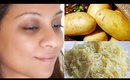 Remove Dark Spots In Just 3 Days│Get Rid Of Uneven Skintone│DIY Potato Facial Mask for Clear Skin