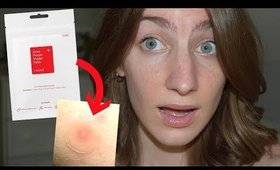 ACNE PATCHES... Do They Work???