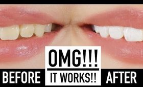 Whiten Teeth Instantly With MAKEUP?! ♥ Wengie