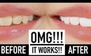 Whiten Teeth Instantly With MAKEUP?! ♥ Wengie