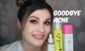 Say Goodbye to Acne!