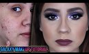 ANNOUNCEMENT! CHIT CHAT TALK THROUGH GALAXY MAKEUP TUTORIAL - ACNE SCARS FULL COVERAGE