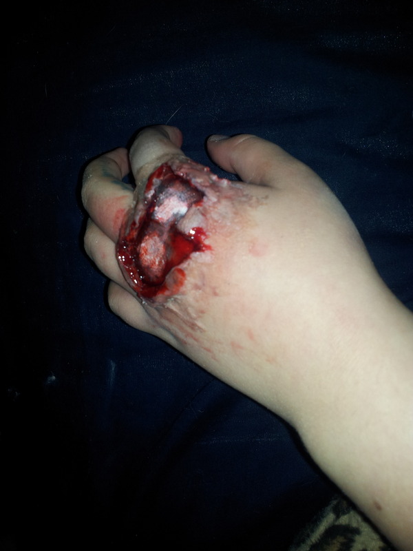 Knuckle Wound | Paige M.'s (missmareeindustries) Photo | Beautylish