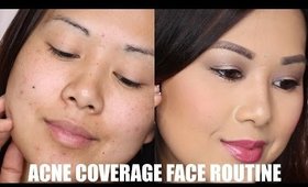 Acne + Dark Spot Coverage Routine | Full Face Concealer + Foundation