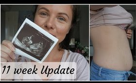 11 Week PREGNANCY Update | Belly Shot + Scan Photos | Danielle Scott