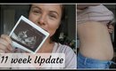 11 Week PREGNANCY Update | Belly Shot + Scan Photos | Danielle Scott
