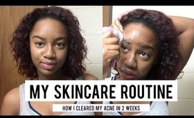 My Skincare Routine - How I Cleared My Acne Up in 2 Weeks!!!