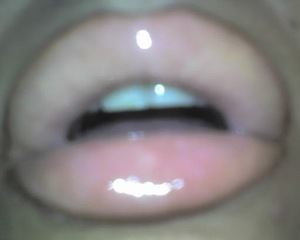 BoaZ LipZ