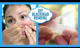 DIY BLACKHEAD REMOVAL! DIY Biore Pore Strips! Does it work?