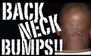 BACK NECK BUMPS & the 3 WORDS YOUR Dr. WON'T TELL YOU!